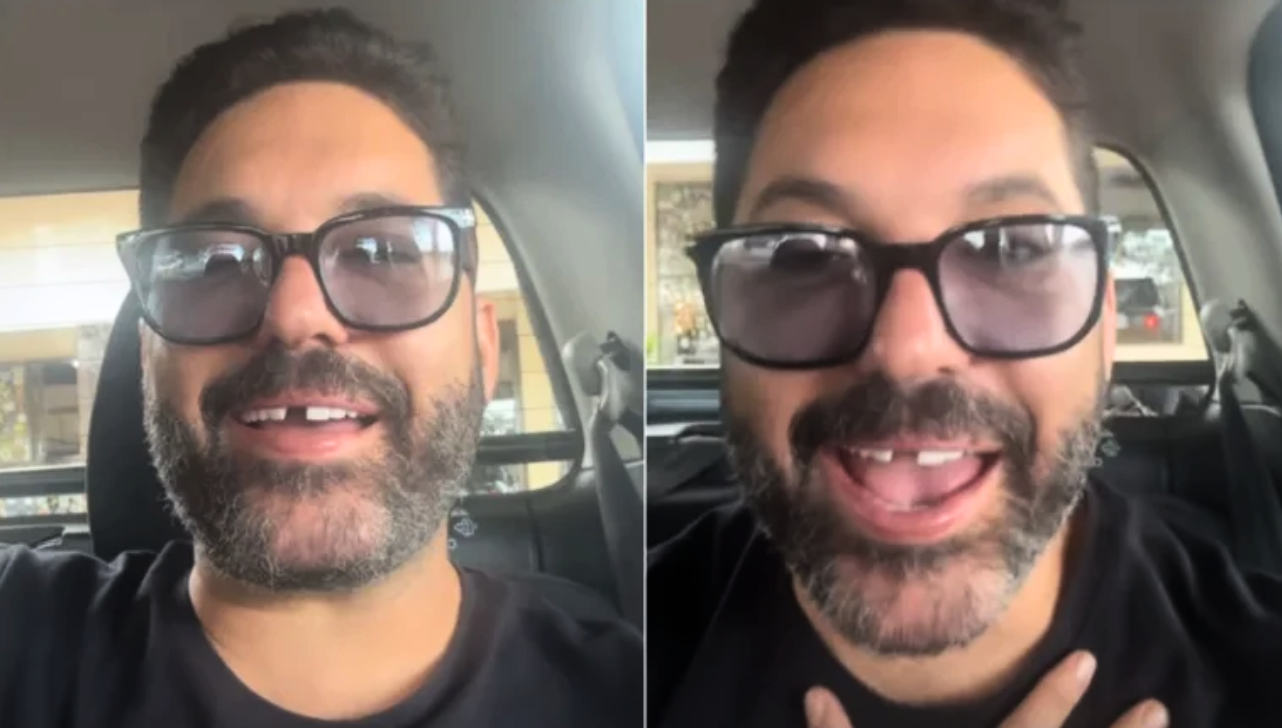 Edson, dupla de Hudson, perde dente antes de show e brinca com a situação