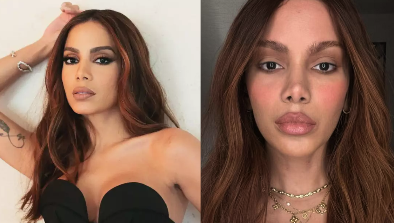 Anitta se pronuncia sobre plásticas no rosto e disse que está ótima
