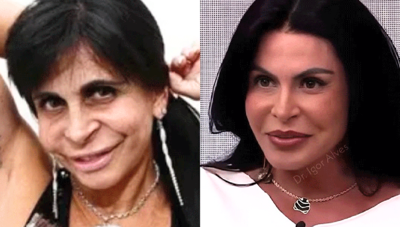 Gretchen rebate críticas sobre procedimentos estéticos e diz que é inveja