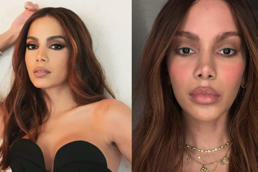 Anitta se pronuncia sobre plásticas no rosto e disse que