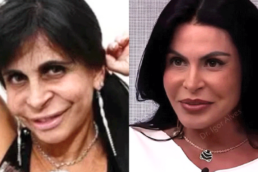 Gretchen rebate críticas sobre procedimentos estéticos e diz que é